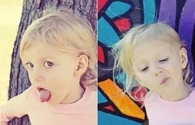 择思达斯经颅磁刺激仪_孩子有抽动症要不要治疗