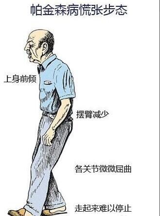 预防帕金森的这五大措施你不得不知