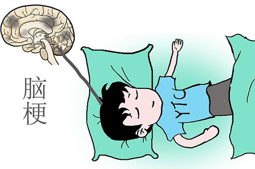 什么是经颅磁?如何预防脑梗塞病人不再复发