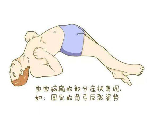 经颅磁刺激治疗仪_脑瘫孩子饮食要注意什么才好呢 