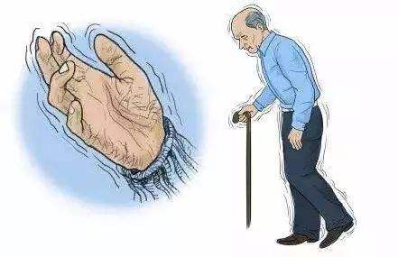 择思达斯经颅磁治疗仪_帕金森治病很花钱吗