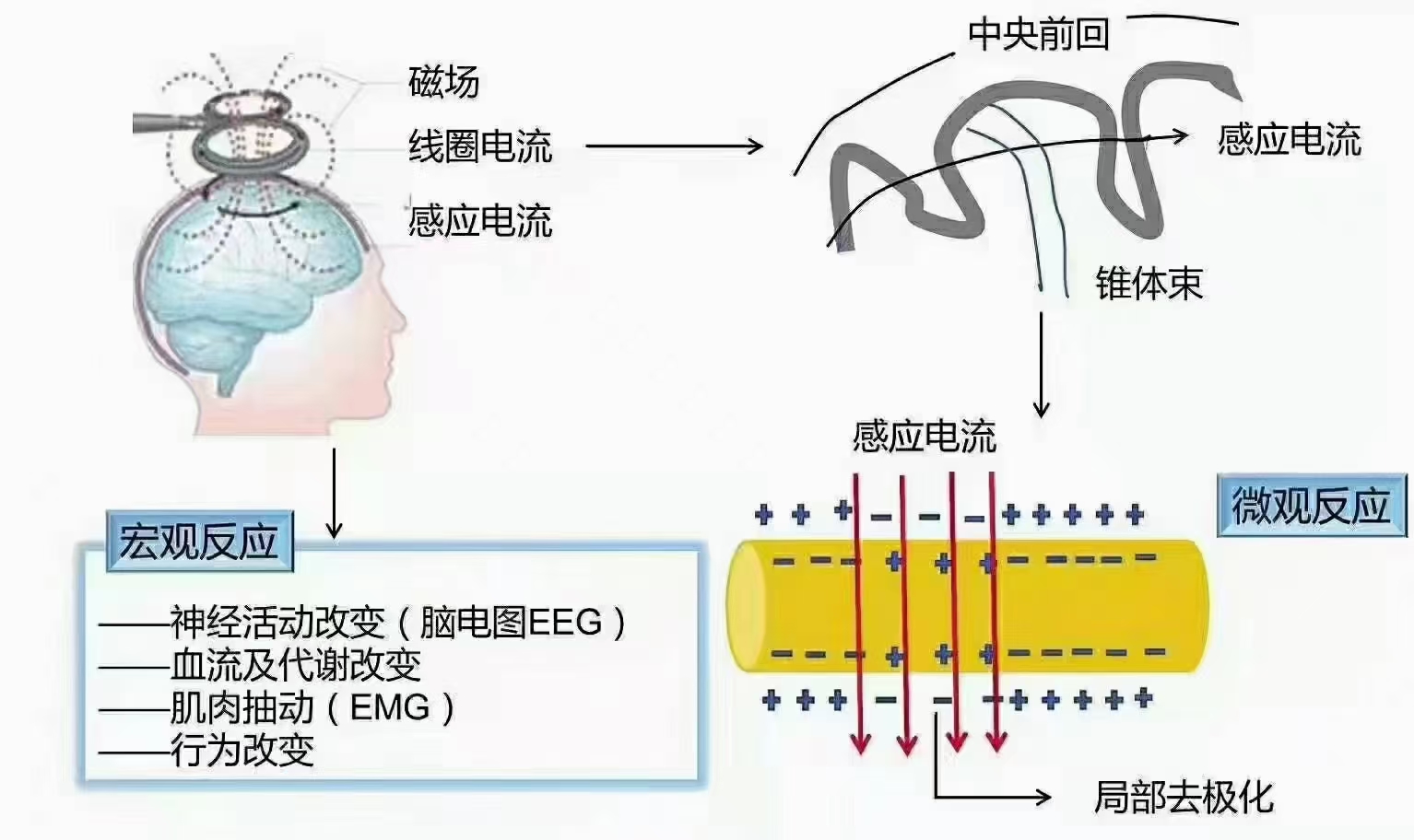 家用的经颅磁治疗仪_小学生注意力差有什么表现