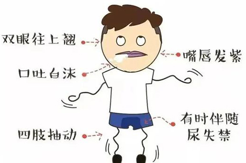 购买家用版的经颅磁_癫痫病发生对智力的影响有多大 